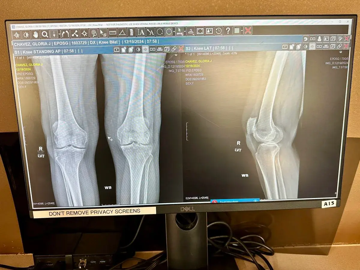 Why every joint solution was missing the same thing